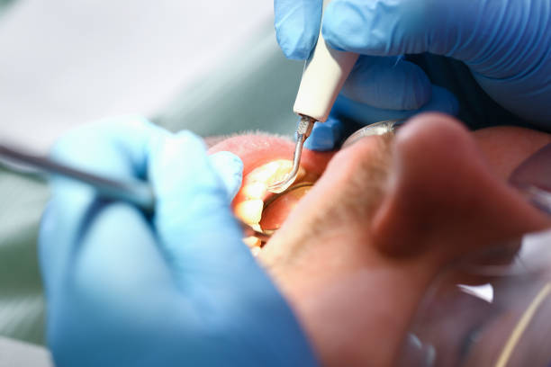 Best Pediatric Emergency Dentist in San Benito, TX