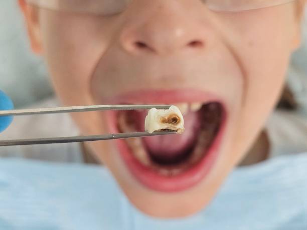 Best Weekend Emergency Dentist in San Benito, TX