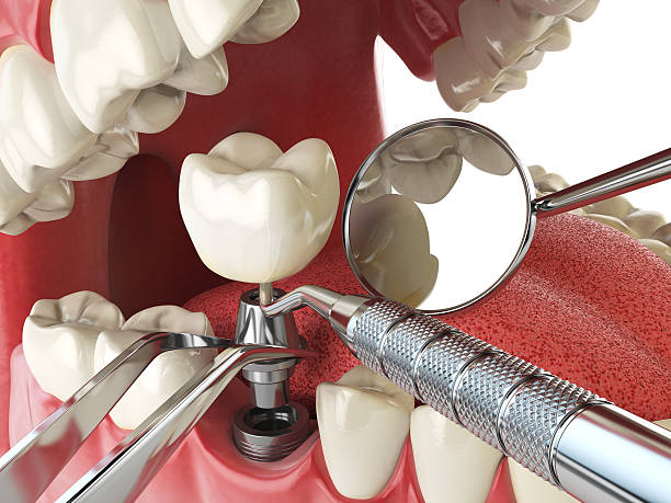 Best Emergency Dental Surgery in San Benito, TX
